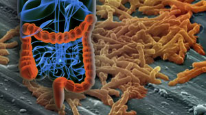 Doxycycline may protect against ceftriaxone-related C. difficile infection Thumbnail
