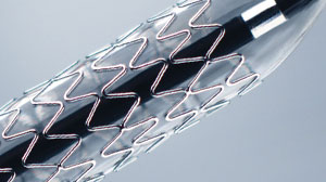 Some drug-eluting stents better than others Thumbnail