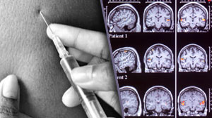 Aripiprazole depot effective as maintenance treatment in schizophrenia Thumbnail