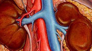 Meta-analysis supports partial nephrectomy for localized renal masses Thumbnail