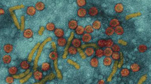 Some rapid hepatitis B screening tests have high diagnostic accuracy Thumbnail