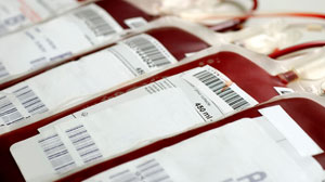 Transfusion to correct anemia of prematurity helpful in poor feeders: study Thumbnail