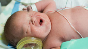 Cycled lighting reduces fussing and crying in preterm infants Thumbnail