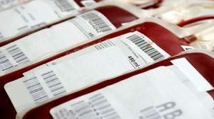 Blood of uncomplicated hemochromatosis patients safe for transfusion Thumbnail