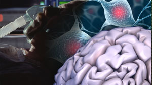 Neurally adjusted ventilatory assist reduces patient-ventilator asynchrony Thumbnail