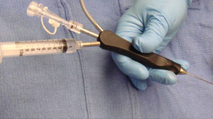 Sialendoscopy works well for obstructive salivary gland disease: meta-analysis Thumbnail