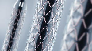 ‘Real-world’ event rates low one year after XIENCE V stent placement Thumbnail