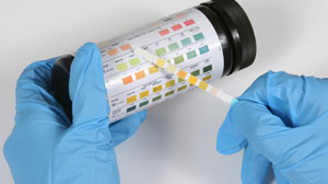 Antibiotic prophylaxis usually unnecessary before shock wave lithotripsy Thumbnail