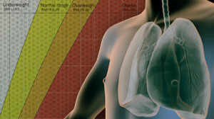 Being overweight may help protect against lung cancer Thumbnail