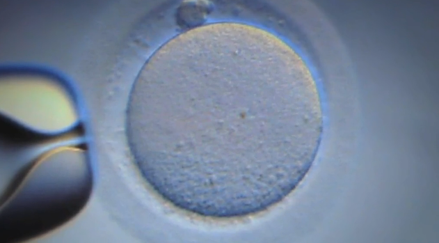 Understanding Infertility in Couples Thumbnail