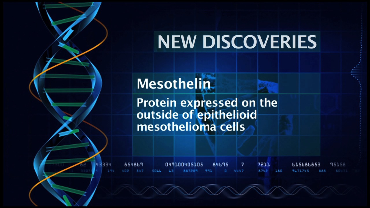 Potential New Treatments for Mesothelioma Thumbnail