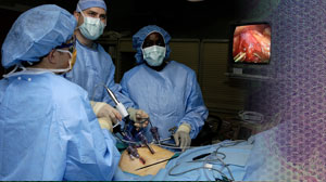 First-line Laparoscopic Lymphocele Fenestration Feasible After Gynecologic Cancer Surgery Thumbnail