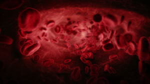 Outcomes Good With Haploidentical Hematopoietic Cell Transplants Plus Cyclophosphamide Thumbnail