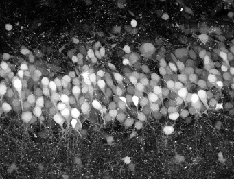 Rafael Yuste: New Tools That Will Read Billions of Neurons in Seconds Thumbnail