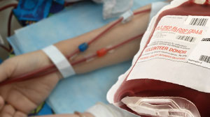 Graft-Versus-Tumor Effect of Hematopoietic Cell Transplantation May be Curative Thumbnail