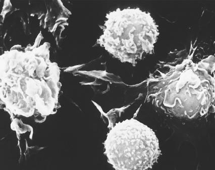 Abagovomab Evokes Immune Response Against Ovarian Cancer but Has No Effect on Survival Thumbnail