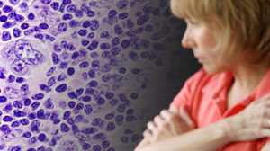 Dual Screening Improves Detection of Early Breast Cancer in Hodgkin Lymphoma Survivors Thumbnail