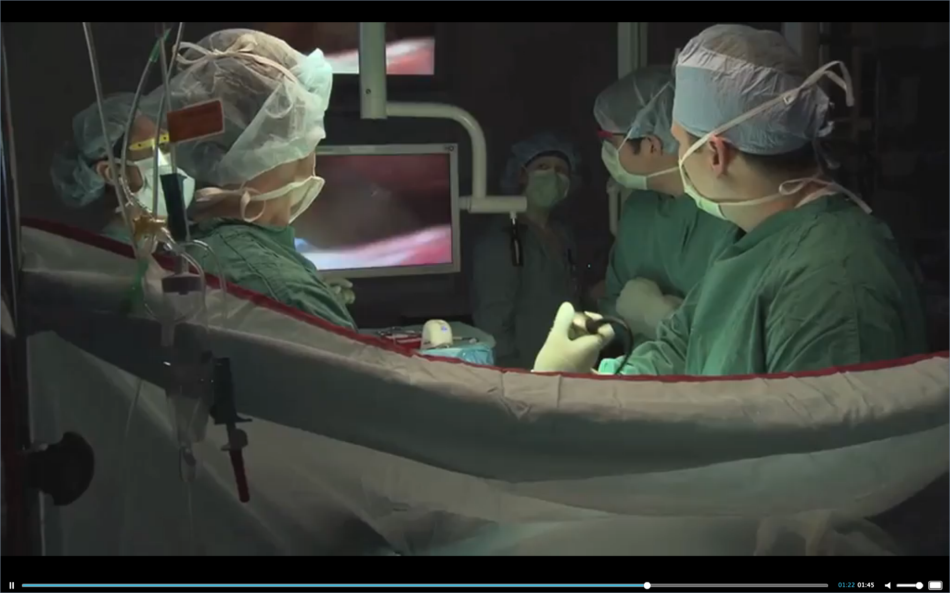 Gastric Bypass Surgery Helpful for Controlling Type 2 Diabetes in Moderately Obese Patients Thumbnail