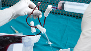 Survival After Hematopoietic Cell Transplantation Has Improved Thumbnail