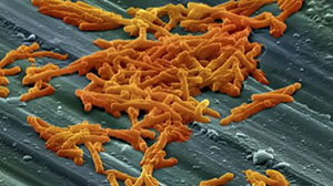 Fidaxomicin Effective for C. Difficile in Cancer Patients Thumbnail