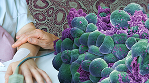 Biomarker Predicts Recurrence of Endometrial Cancer Thumbnail