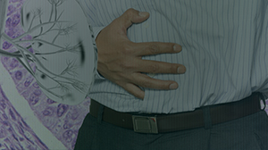 Prostate Cancer Hormonal Therapy Tied to Kidney Risks Thumbnail