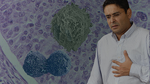Cancer Risk Increased in Azoospermic Men Thumbnail