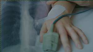 Drug Combo Improves Survival in Advanced NSCLC Thumbnail