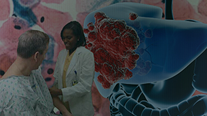 Scoring Tool Predicts Outcome of Liver Cancer Treated with Arterial Embolization Thumbnail
