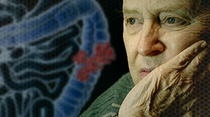 Adjuvant Chemo Benefits Elderly Colon Cancer Patients Thumbnail