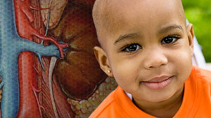 Premature Renal Failure Risk Increased for Some Childhood Cancer Survivors Thumbnail