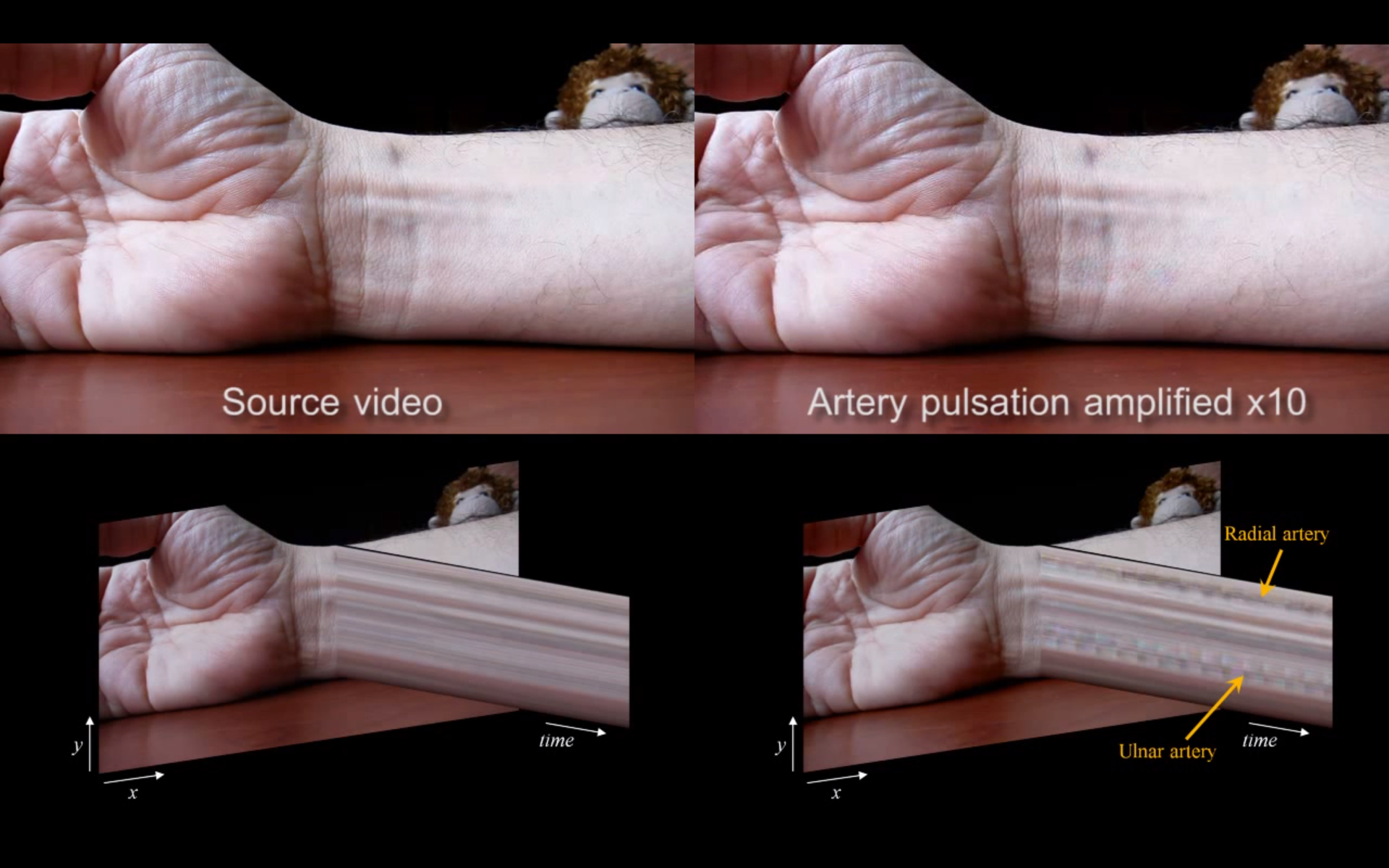 App Reveals Scientific Breakthrough Hidden Under Your Skin Thumbnail