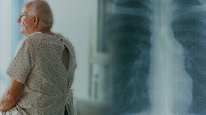 Annual CT Screening for Lung Cancer Should Continue at Least 10 Years Thumbnail