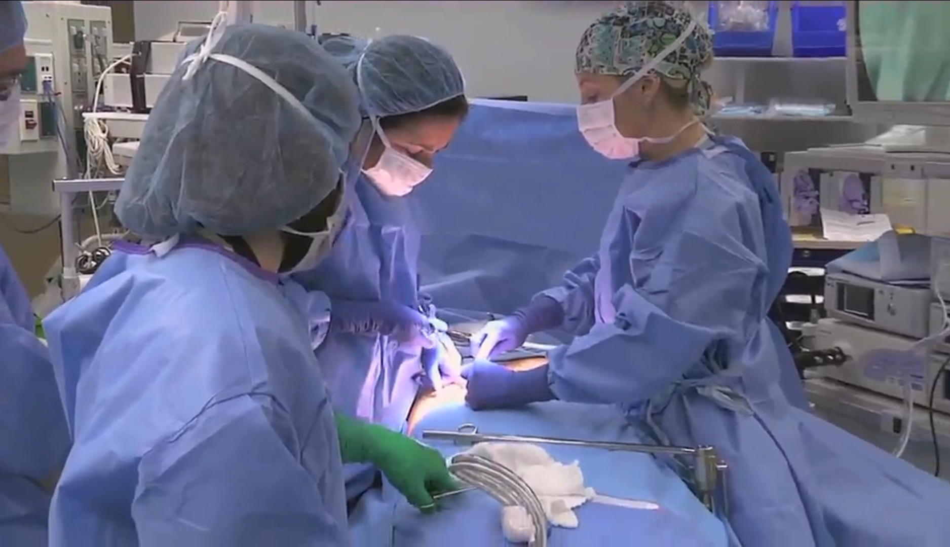 Substantial Weight Loss Three Years After Bariatric Surgery for Severely Obese Individuals Thumbnail