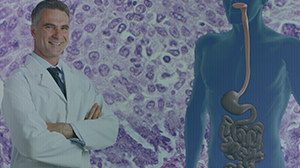 Nomogram Predicts Individual Benefit of Neoadjuvant CRT in Esophageal Cancer Thumbnail