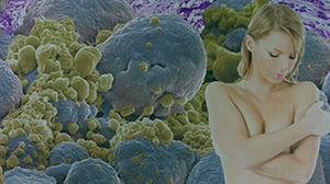 Trastuzumab has Moderate Benefit in HER2-Negative Breast Cancer Thumbnail