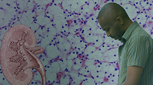 Temsirolimus Does Not Improve Survival in Metastatic Renal Cell Carcinoma Thumbnail