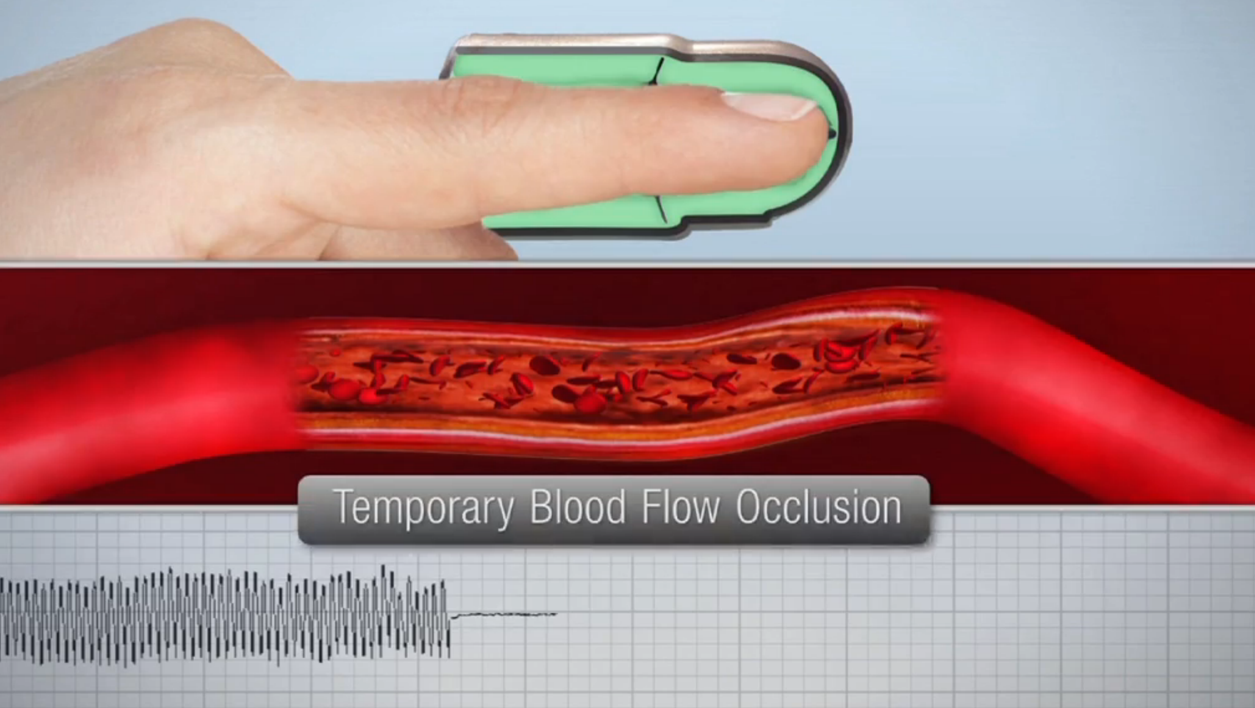 15-Minute Cardiac Health Test Every Doctor’s Office Needs Thumbnail