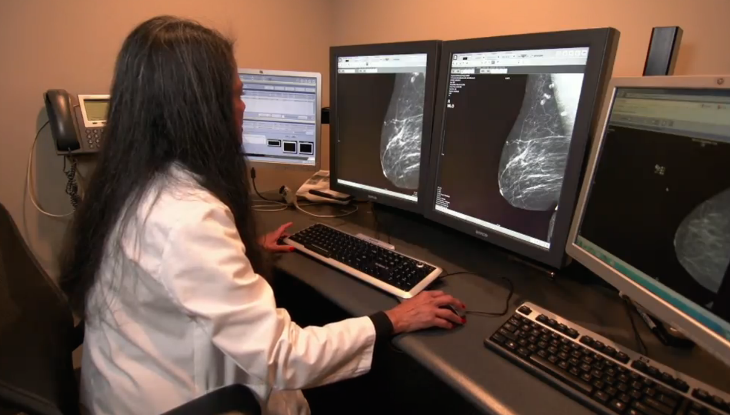 Maximizing Benefits of Mammogram Screening Should Be Based on Patient Factors and Age Thumbnail