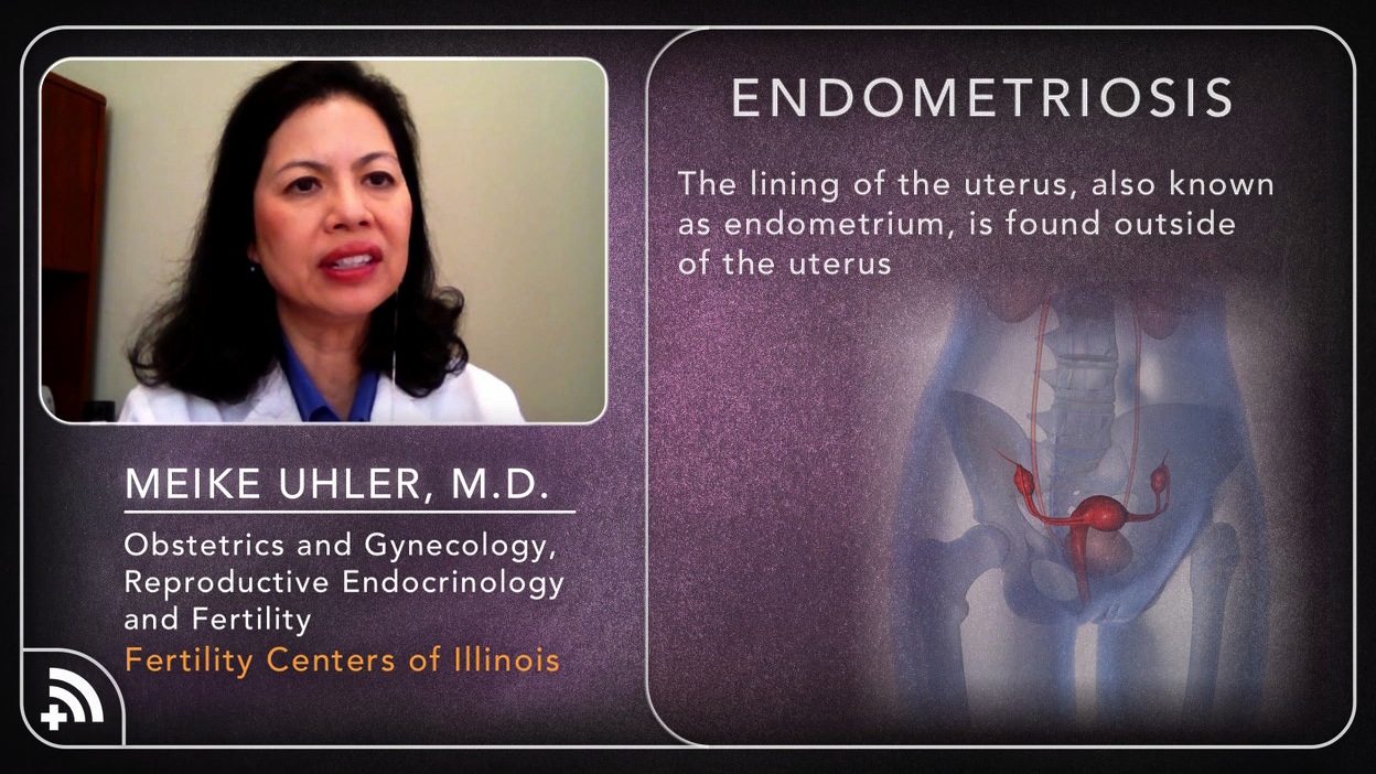 Endometriosis: The Painful Condition Your Patients Don’t Know They Have Thumbnail