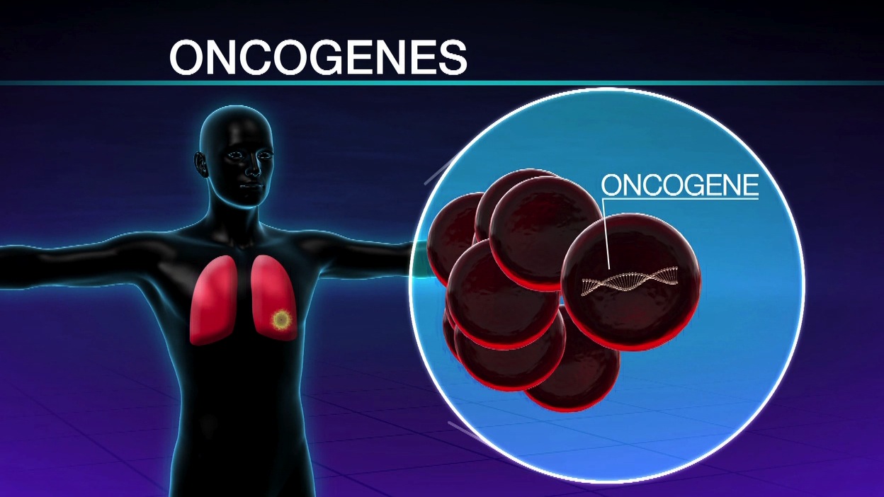 Genetic Testing Can Help Identify Targeted Lung Cancer Treatment Thumbnail