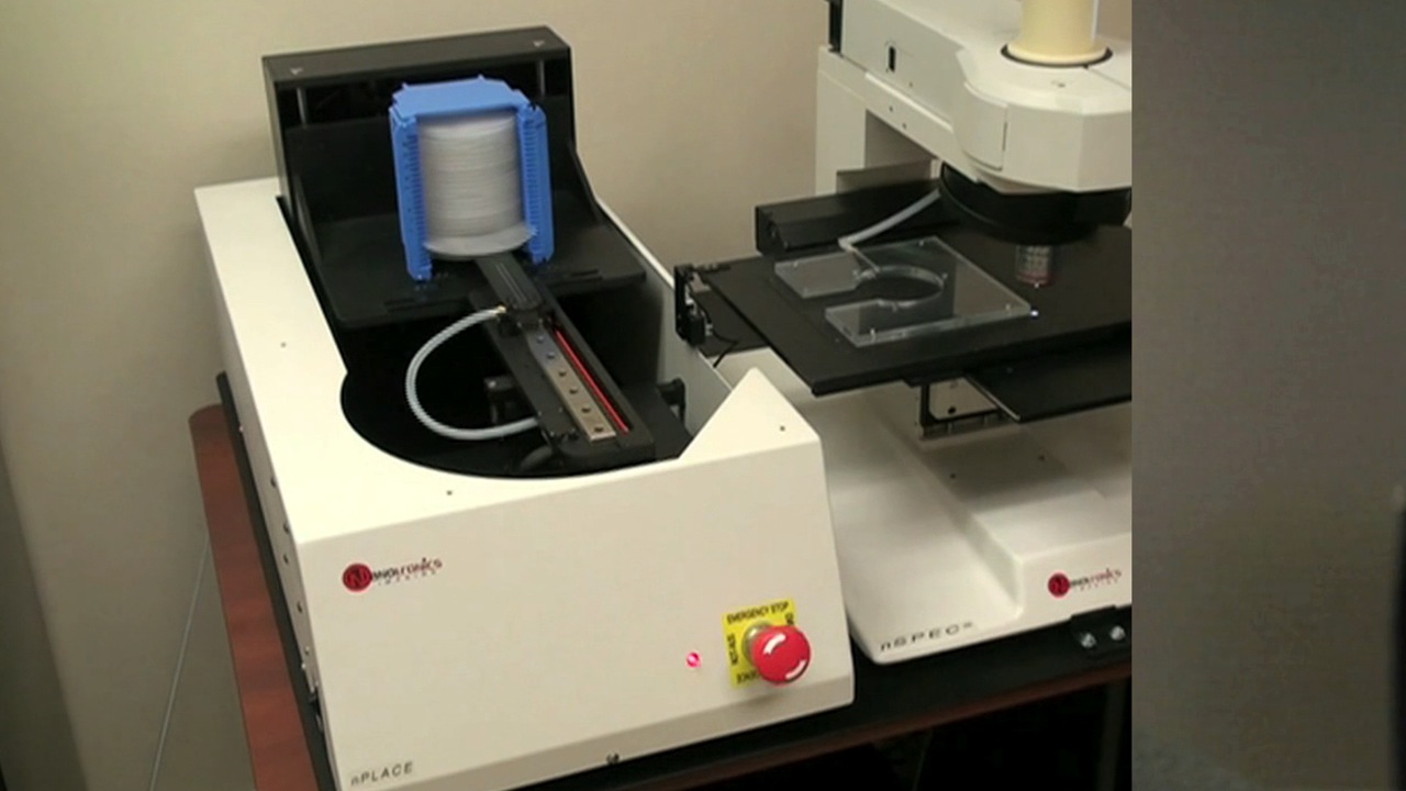 Can a Simple Imaging Device Save Thousands from Cervical Cancer? Thumbnail