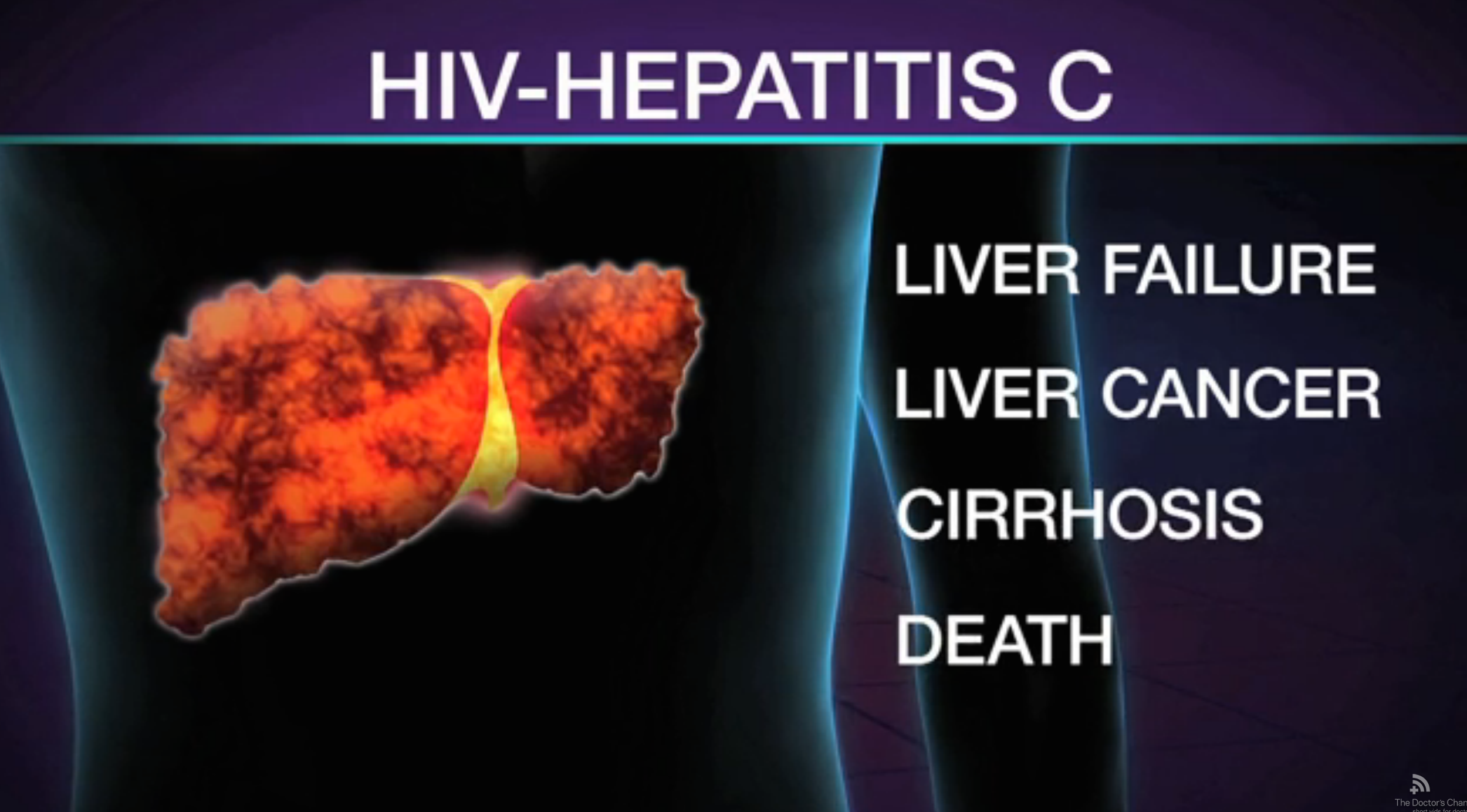 New Interferon-Free Medications Successfully Treat Hepatitis C in Patients with HIV Thumbnail