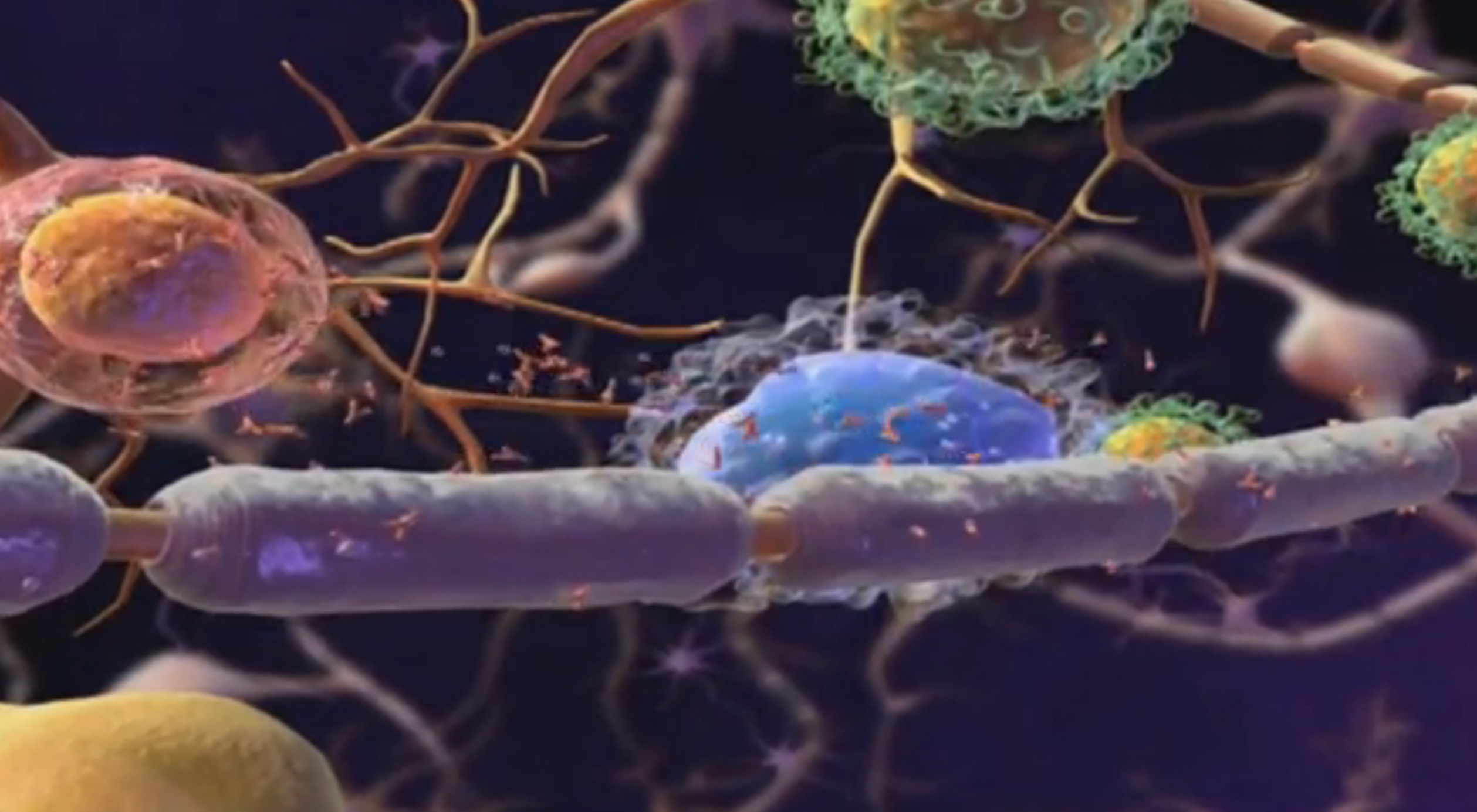 How a One-of-a-Kind Drug Will Change the Landscape of MS Therapy Thumbnail