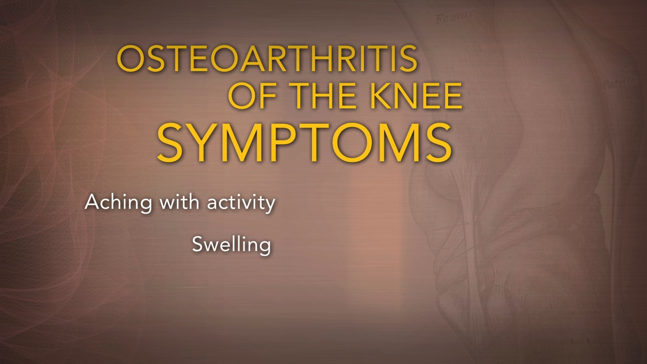 Top 5 Symptoms and Treatments for Osteoarthritis of the Knee Thumbnail
