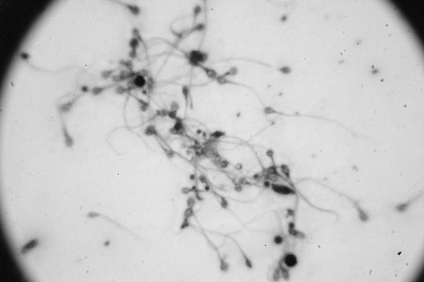 Scientists Successfully Create Lab-Grown Sperm, Egg Thumbnail