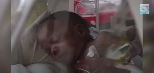 Why Does the US Have Such a High Preterm Birthrate? Thumbnail