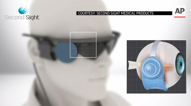 Blind Man Marks 1 Year with ‘Bionic’ Eye Thumbnail