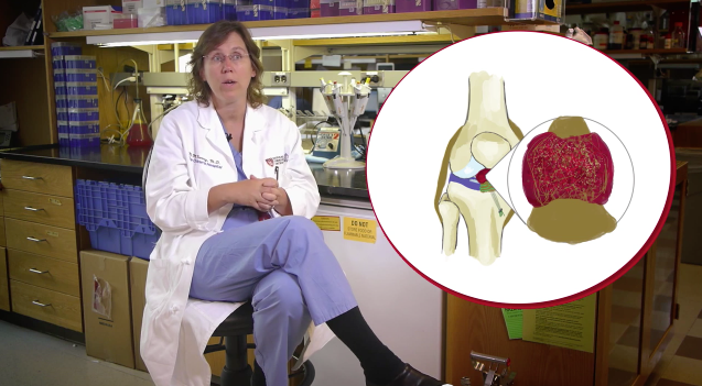 Breakthrough Treatment for ACL Injuries Thumbnail