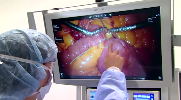 Robot Surgeons are the Future of Medicine Thumbnail